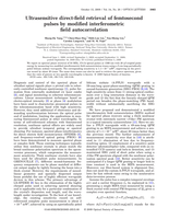 Ultrasensitive direct-field retrieval of femtosecond pulses by modified interferometric field autocorrelation