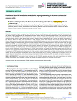 Forkhead box M1 mediates metabolic reprogramming in human colorectal cancer cells